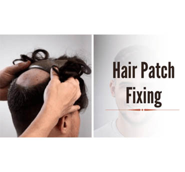 Hair Wig and Patch Fixing